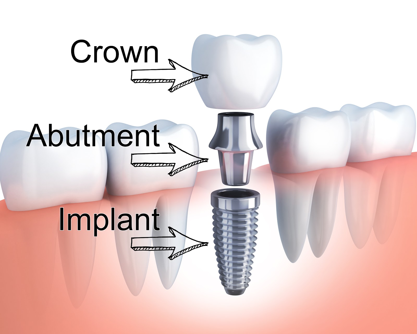 Dental treatment and modern restorative dentistry